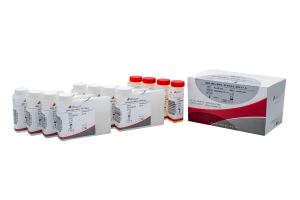 bilirubin / audit / بیلی روبین / ادیت / کیت / بیوشیمی / 